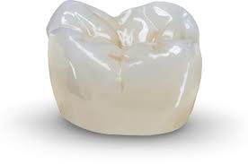 Can Dental Lab Fees Lower Overhead and Increase Profits?